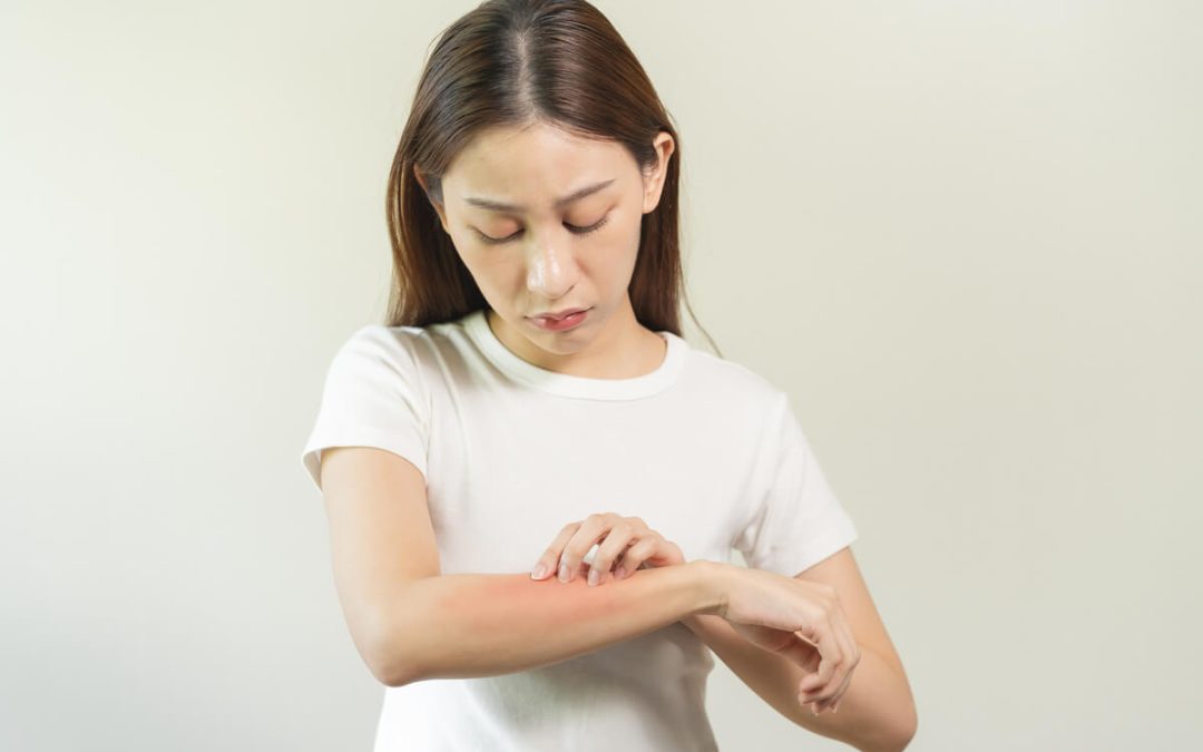 Osip po tijelu i svrbež: kada je povezano, a kada nije