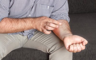 Zašto se javlja svrbež kod psorijaze i što ga zapravo uzrokuje?