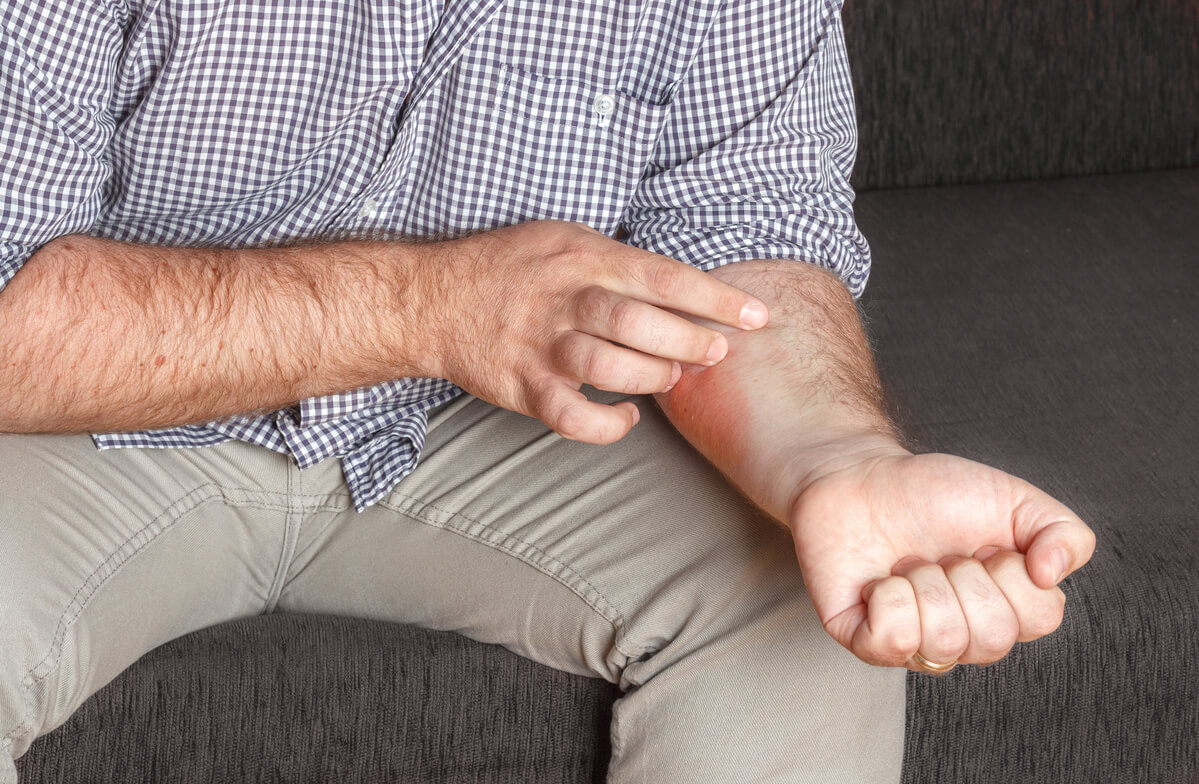 Da li psorijaza svrbi (1) (1)