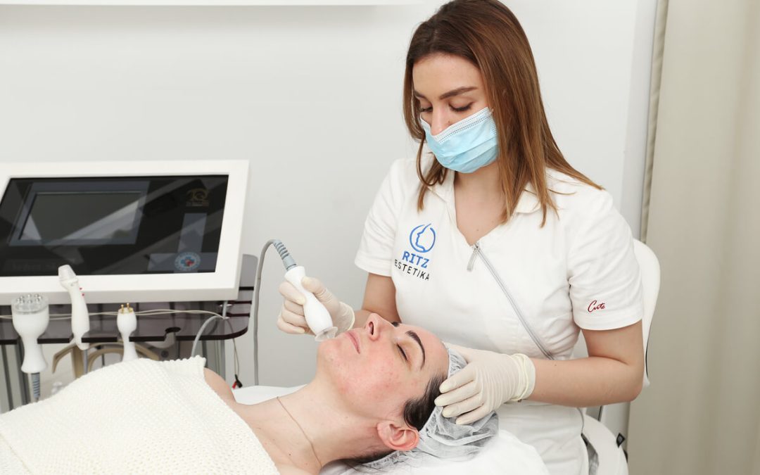 Kad koža govori: što nam akne na licu pokušavaju reći?