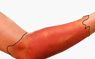 Crveni vjetar – zašto se često pojavi “iznenada” i kako ga ljudi najčešće opisuju