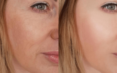 Nova definicija elegancije: zašto bore oko usana više nisu tabu tema